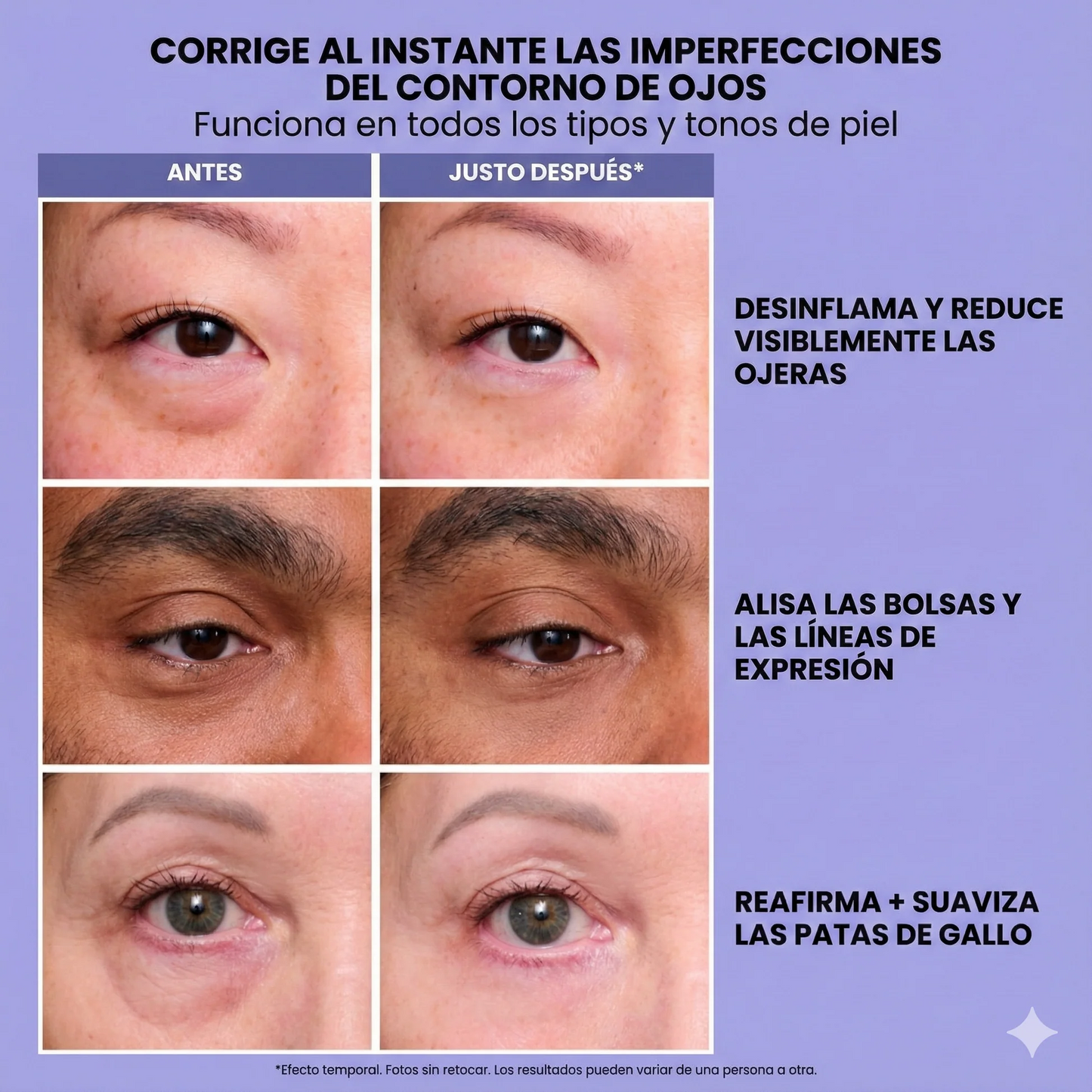 SeraGlow - Gel tensor rejuvenecedor de ojos